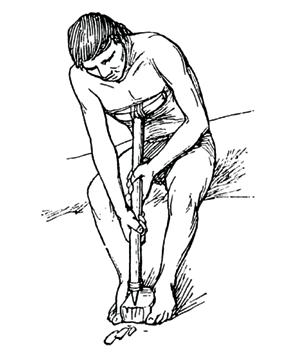 Figure 3. Pressure microblading technique